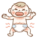 Diaper Rash